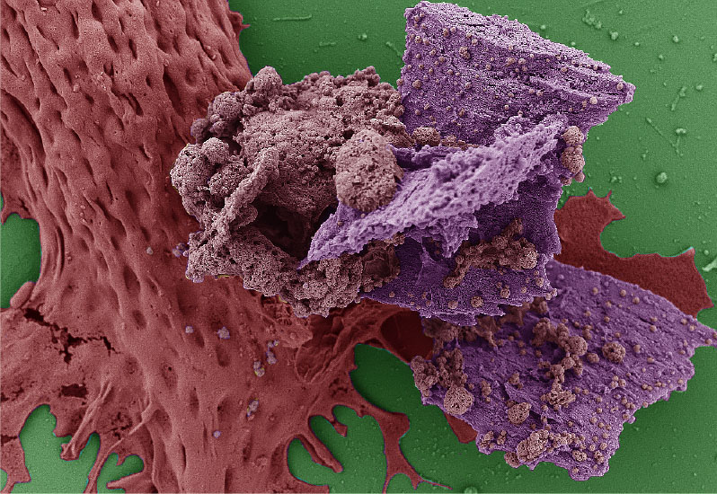 2018 Electron Microscope - Runner up