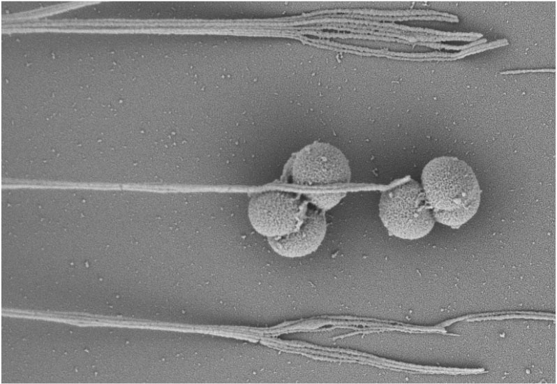 2018 Electron Microscope - Winner
