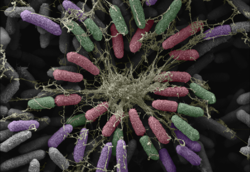 2018 Electron Microscope - Winner