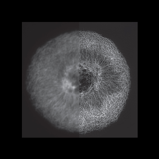 Super-Resolution