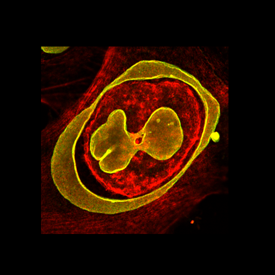 Live Cell Confocal