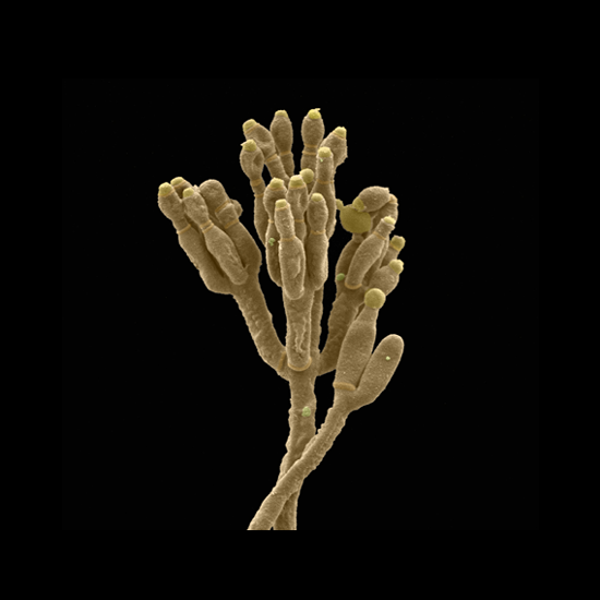 SEM image
